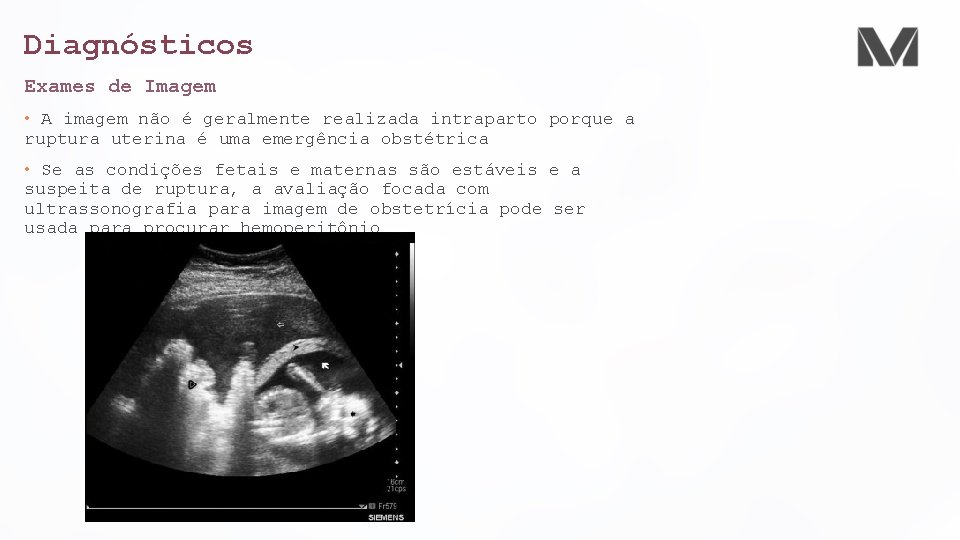 Diagnósticos Exames de Imagem • A imagem não é geralmente realizada intraparto porque a