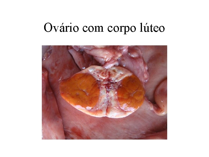 Ovário com corpo lúteo 