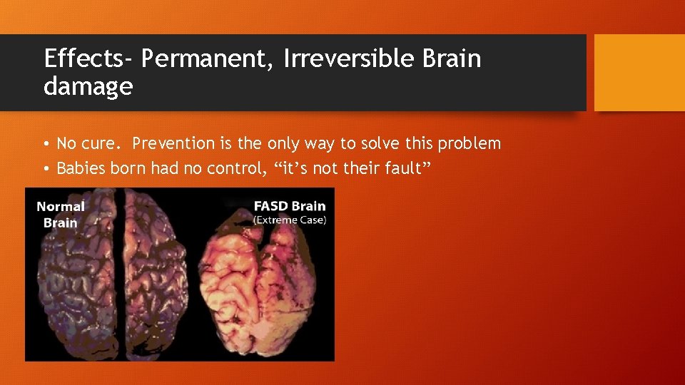 Effects- Permanent, Irreversible Brain damage • No cure. Prevention is the only way to