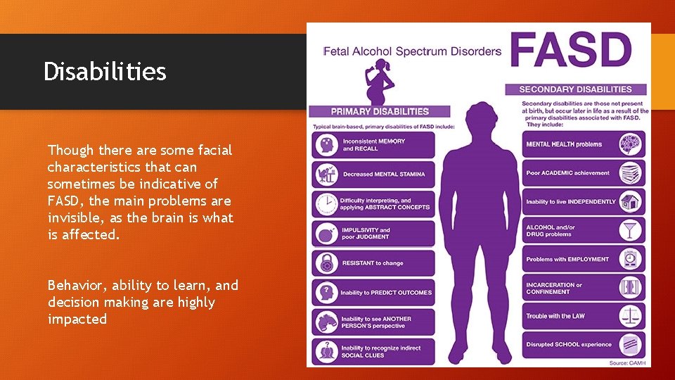 Disabilities Though there are some facial characteristics that can sometimes be indicative of FASD,