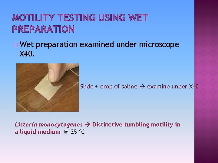 MOTILITY TESTING USING WET PREPARATION � Wet preparation examined under microscope X 40. Slide