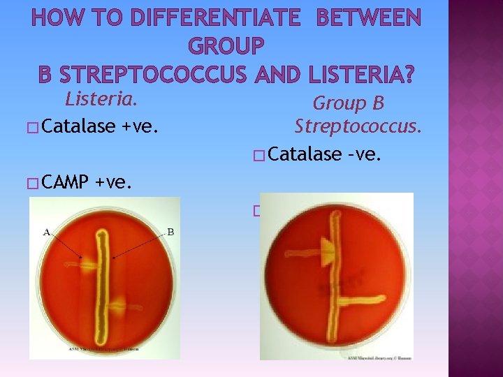 HOW TO DIFFERENTIATE BETWEEN GROUP B STREPTOCOCCUS AND LISTERIA? Listeria. � Catalase +ve. �