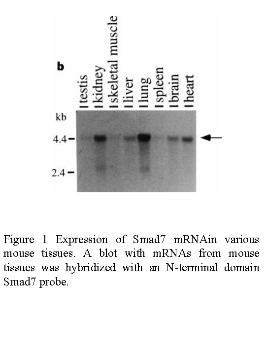 Figure 1 Expression of Smad 7 m. RNAin various mouse tissues. A blot with