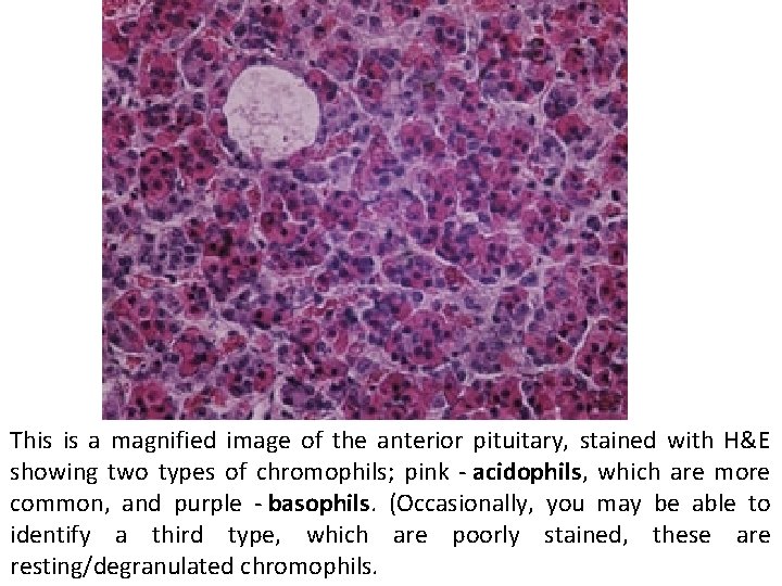 This is a magnified image of the anterior pituitary, stained with H&E showing two