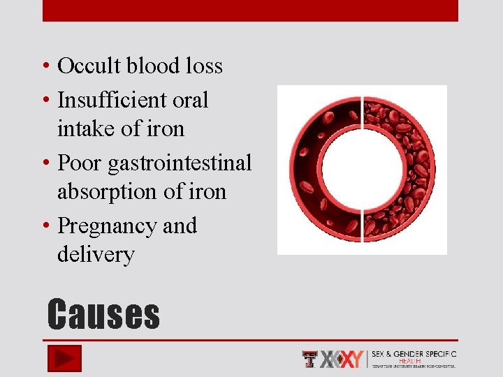  • Occult blood loss • Insufficient oral intake of iron • Poor gastrointestinal