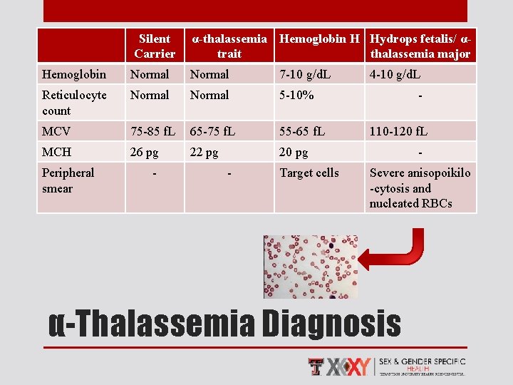 Silent Carrier α-thalassemia Hemoglobin H Hydrops fetalis/ αtrait thalassemia major Hemoglobin Normal 7 -10