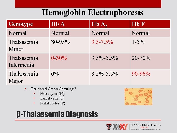 Hemoglobin Electrophoresis Genotype Hb A 2 Hb F Normal Thalassemia Minor 80 -95% 3.