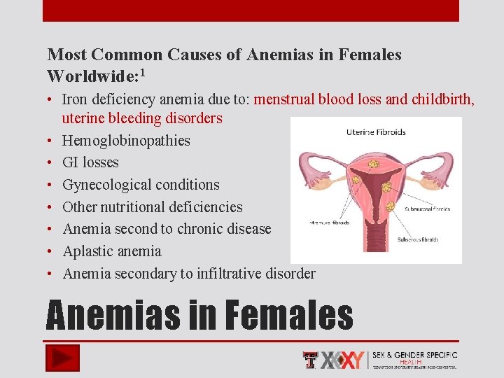 Most Common Causes of Anemias in Females Worldwide: 1 • Iron deficiency anemia due