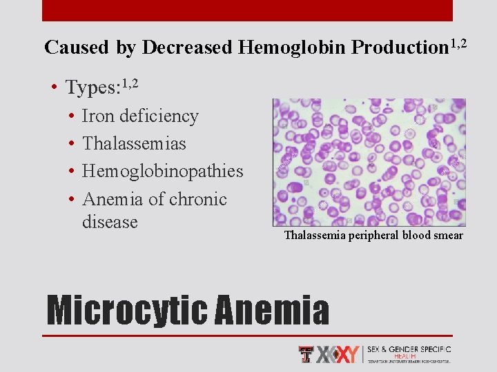 Caused by Decreased Hemoglobin Production 1, 2 • Types: 1, 2 • • Iron