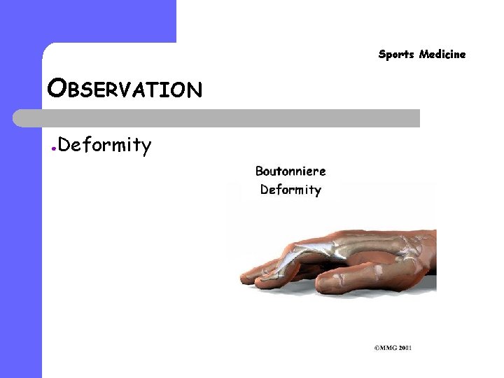 Sports Medicine OBSERVATION ● Deformity 