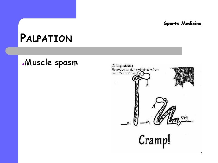 Sports Medicine PALPATION ● Muscle spasm 