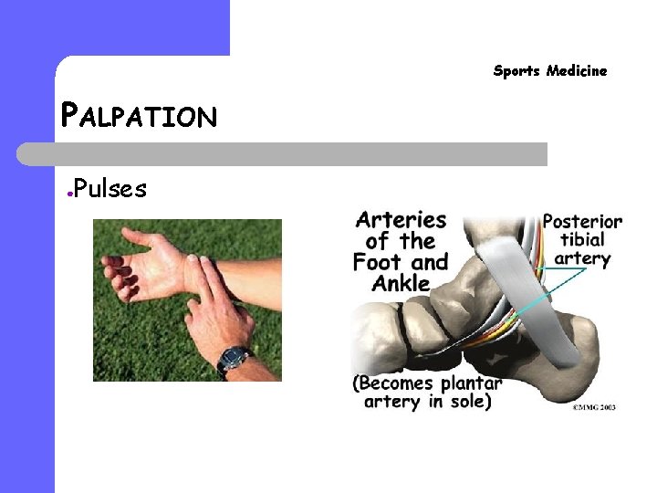 Sports Medicine PALPATION ● Pulses Sports Medicine PALPATION ● Pulses