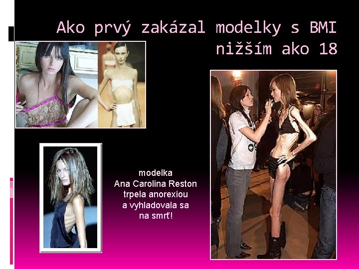 Ako prvý zakázal modelky s BMI nižším ako 18 modelka Ana Carolina Reston trpela