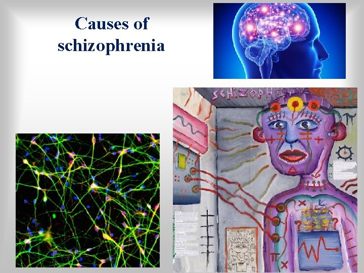 Causes of schizophrenia 