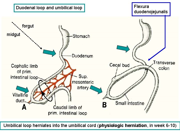 Duodenal loop and umbilical loop Flexura duodenojejunalis forgut midgut Umbilical loop herniates into the
