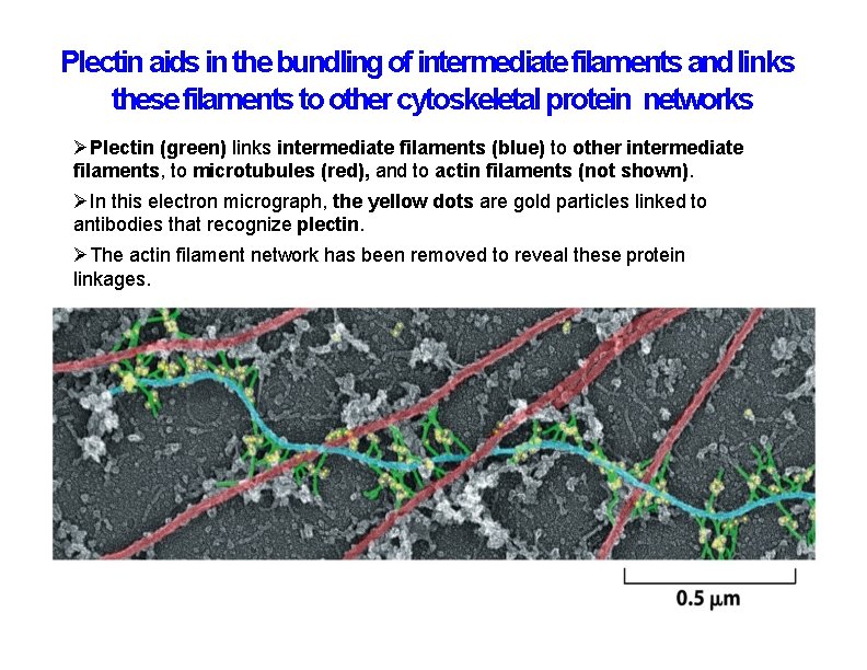 Plectin aids in the bundling of intermediate filaments and links these filaments to other