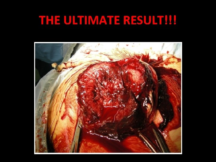 THE ULTIMATE RESULT!!! 