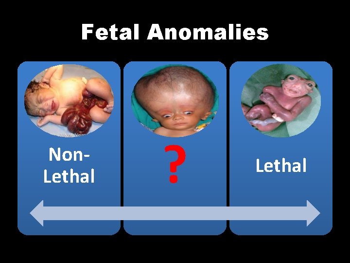 Fetal Anomalies Non. Lethal ? Lethal 