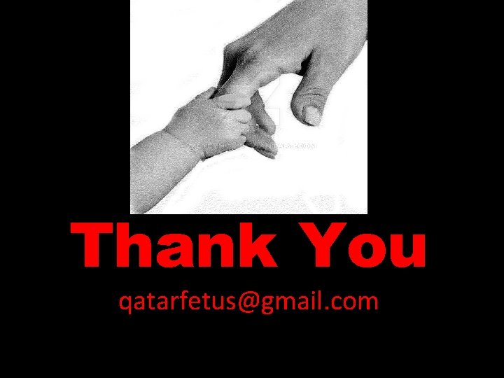 Thank You qatarfetus@gmail. com 