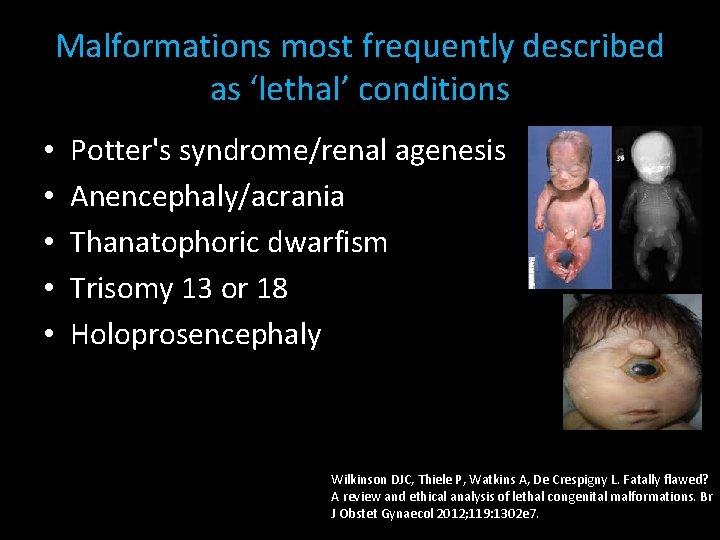 Malformations most frequently described as ‘lethal’ conditions • • • Potter's syndrome/renal agenesis Anencephaly/acrania