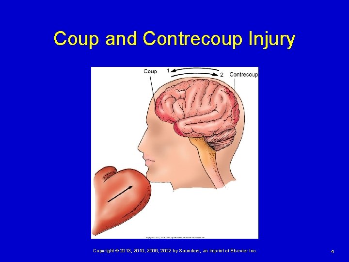 Coup and Contrecoup Injury Copyright © 2013, 2010, 2006, 2002 by Saunders, an imprint