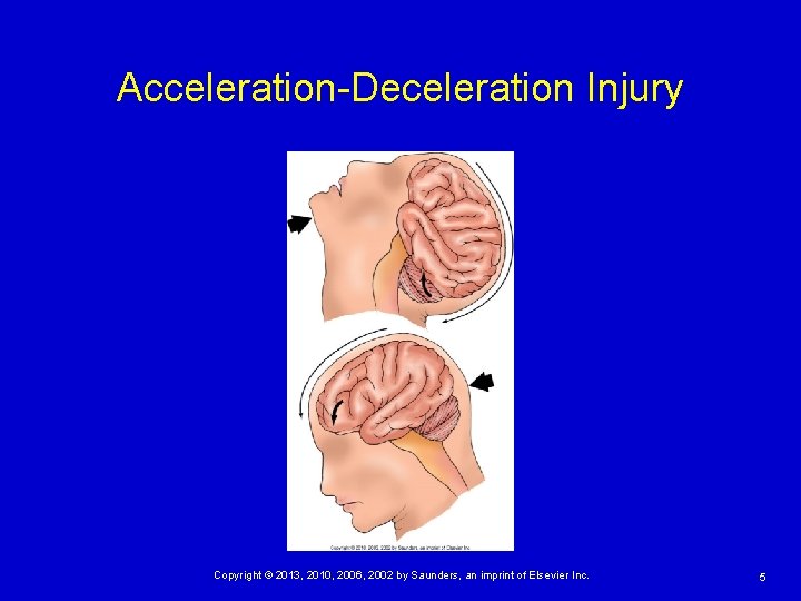 Acceleration-Deceleration Injury Copyright © 2013, 2010, 2006, 2002 by Saunders, an imprint of Elsevier