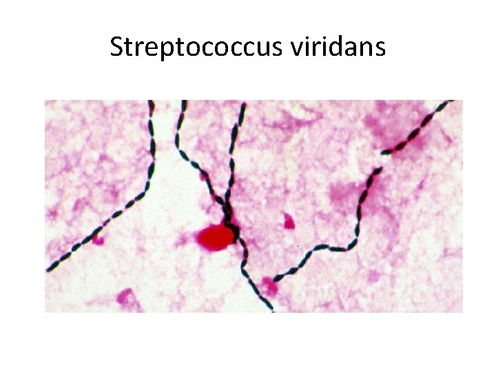 Streptococcus viridans 