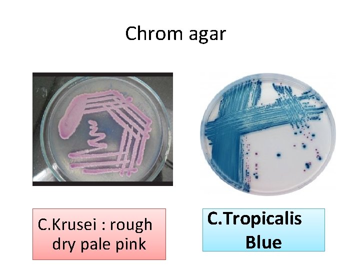 Chrom agar C. Krusei : rough dry pale pink C. Tropicalis Blue 