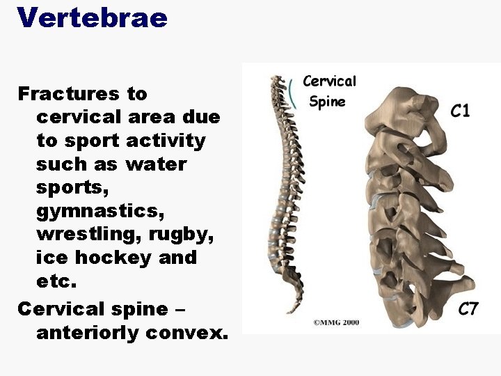 Vertebrae Fractures to cervical area due to sport activity such as water sports, gymnastics,
