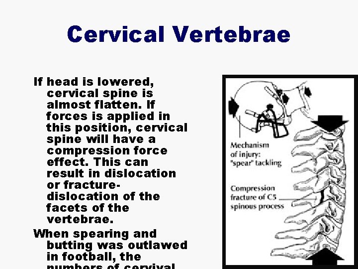 Cervical Vertebrae If head is lowered, cervical spine is almost flatten. If forces is