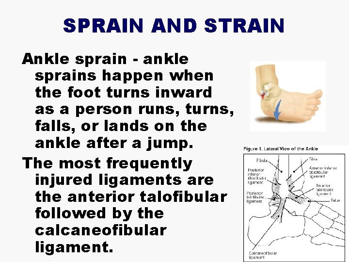 SPRAIN AND STRAIN Ankle sprain - ankle sprains happen when the foot turns inward