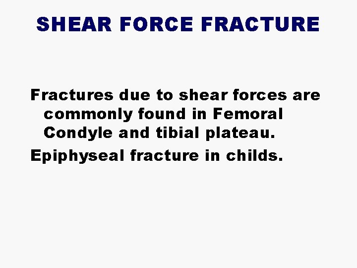 SHEAR FORCE FRACTURE Fractures due to shear forces are commonly found in Femoral Condyle