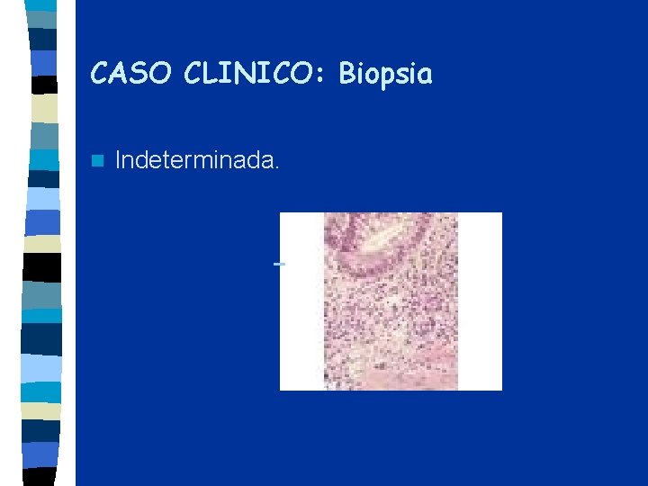 CASO CLINICO: Biopsia n Indeterminada. 