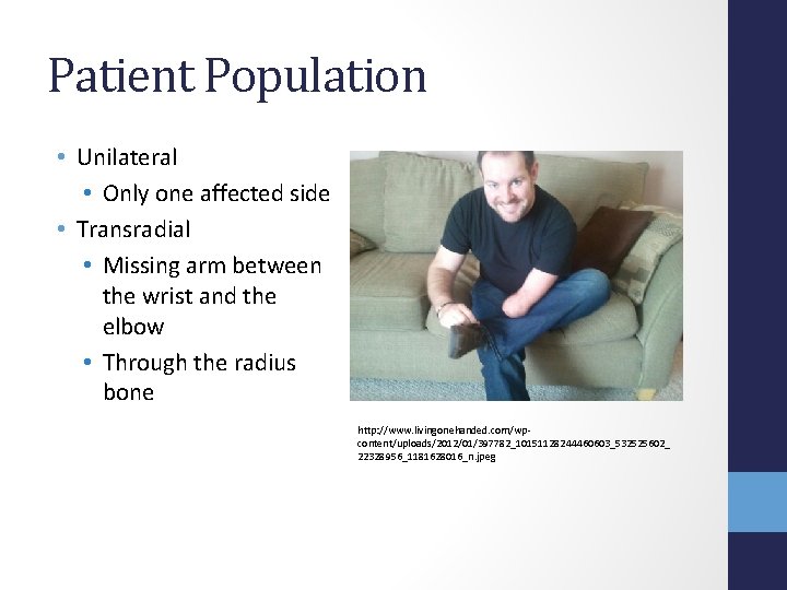 Patient Population • Unilateral • Only one affected side • Transradial • Missing arm