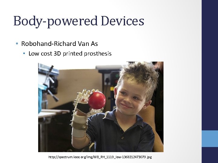 Body-powered Devices • Robohand-Richard Van As • Low cost 3 D printed prosthesis http: