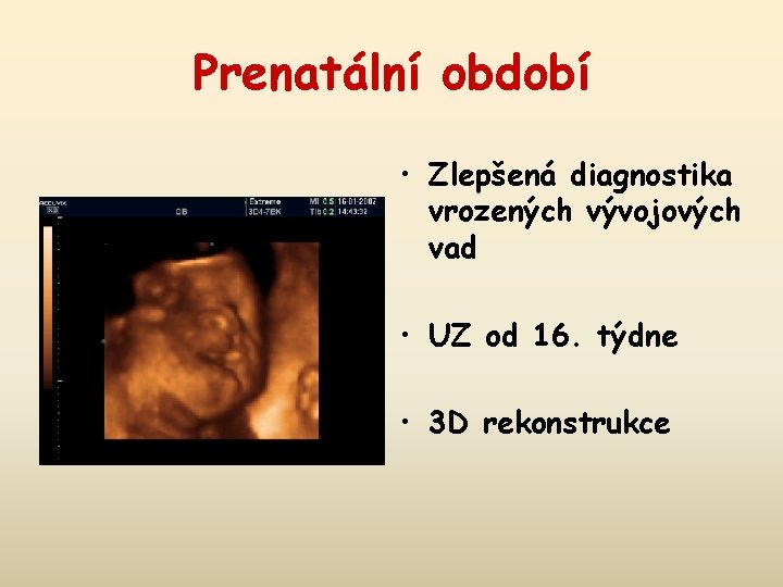 Prenatální období • Zlepšená diagnostika vrozených vývojových vad • UZ od 16. týdne •