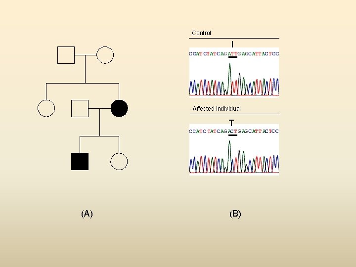 Control I Affected individual T (A) (B) 