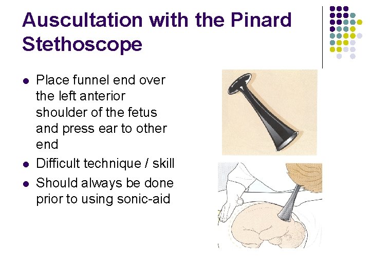 Auscultation with the Pinard Stethoscope l l l Place funnel end over the left