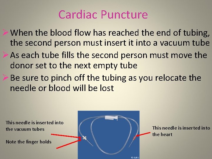 Cardiac Puncture Ø When the blood flow has reached the end of tubing, the