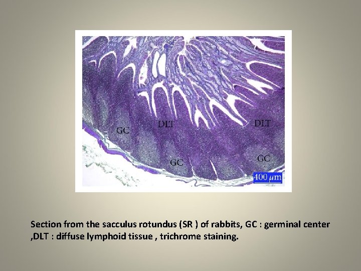 Section from the sacculus rotundus (SR ) of rabbits, GC : germinal center ,