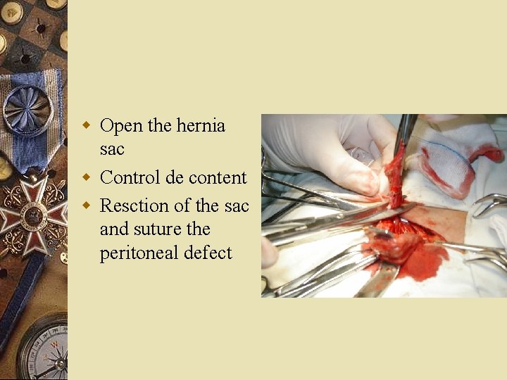 w Open the hernia sac w Control de content w Resction of the sac