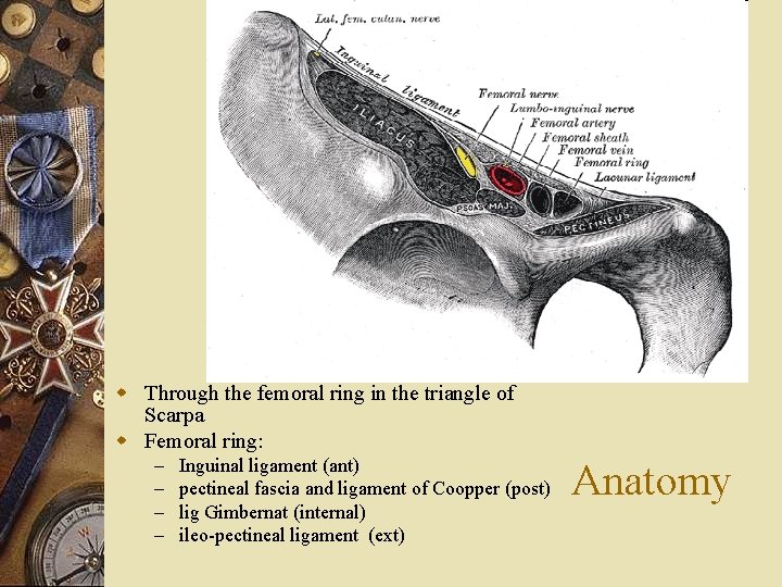w Through the femoral ring in the triangle of Scarpa w Femoral ring: –