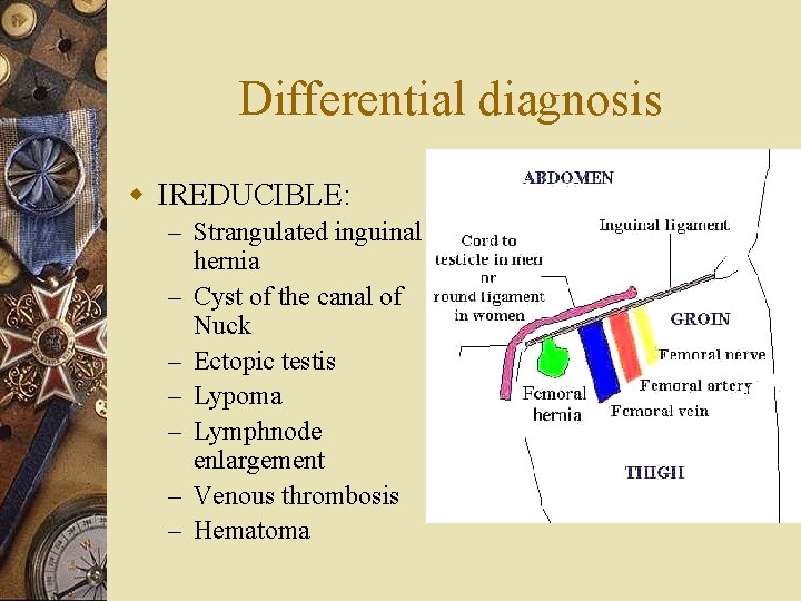 Differential diagnosis w IREDUCIBLE: – Strangulated inguinal hernia – Cyst of the canal of