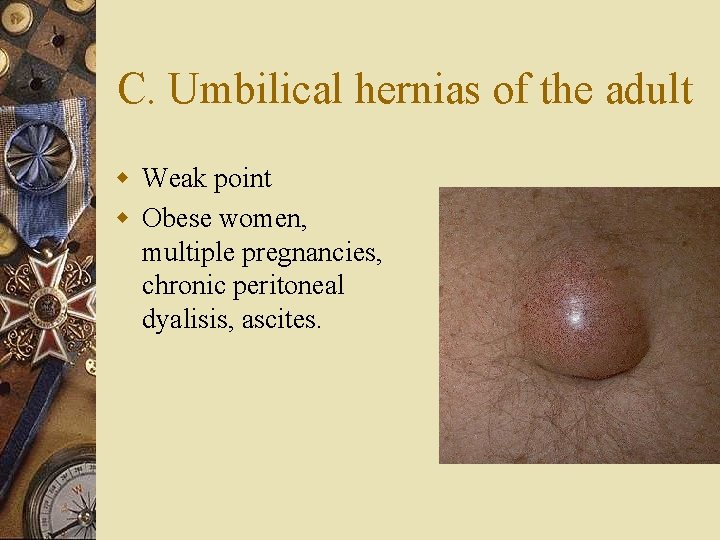 C. Umbilical hernias of the adult w Weak point w Obese women, multiple pregnancies,