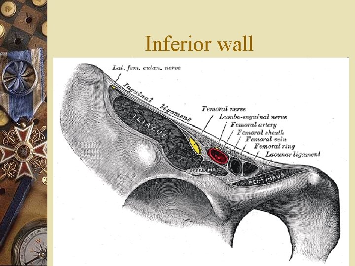 Inferior wall 