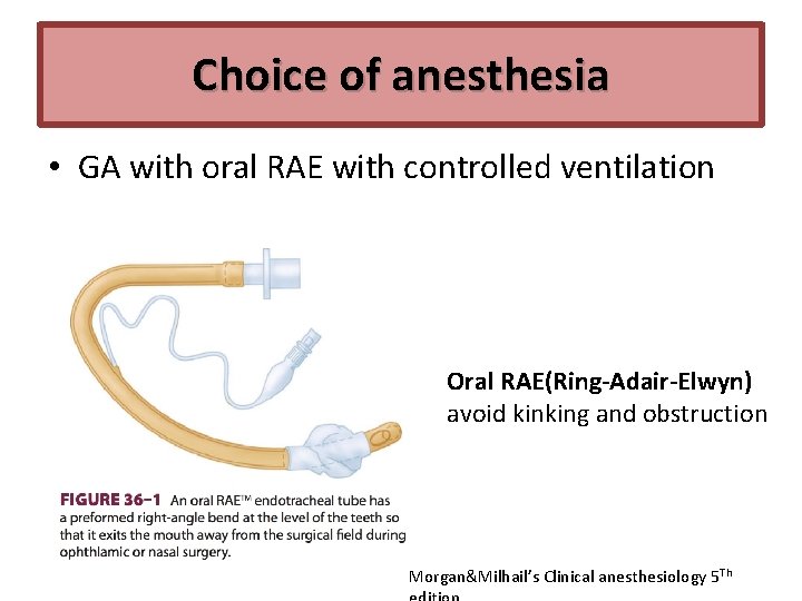 Choice of anesthesia • GA with oral RAE with controlled ventilation Oral RAE(Ring-Adair-Elwyn) avoid