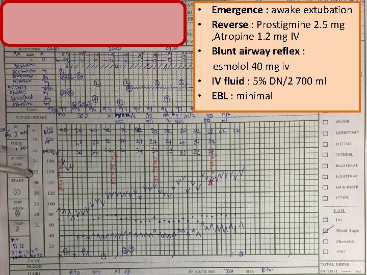  • Emergence : awake extubation • Reverse : Prostigmine 2. 5 mg ,