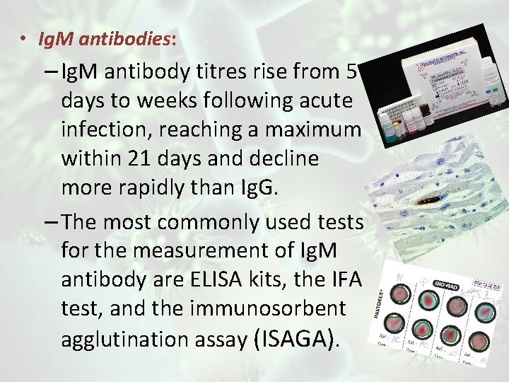  • Ig. M antibodies: – Ig. M antibody titres rise from 5 days