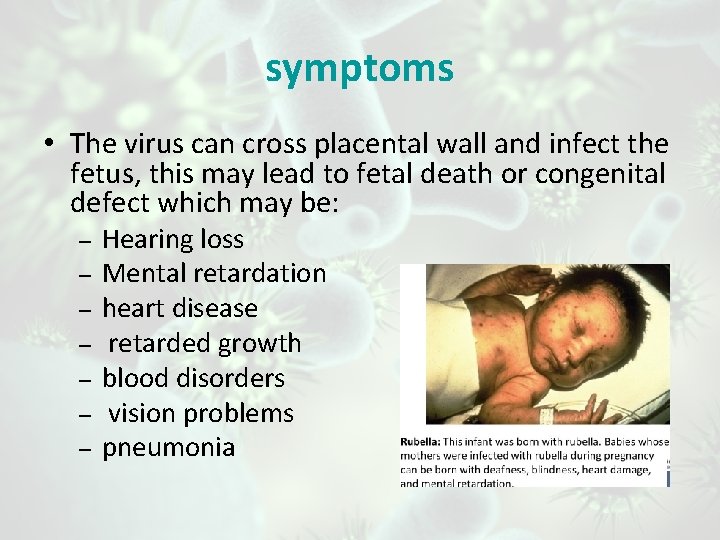 symptoms • The virus can cross placental wall and infect the fetus, this may