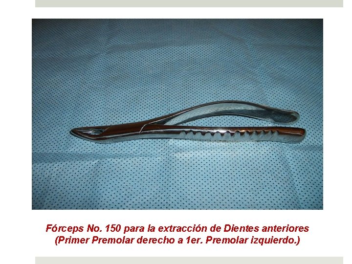 Fórceps No. 150 para la extracción de Dientes anteriores (Primer Premolar derecho a 1